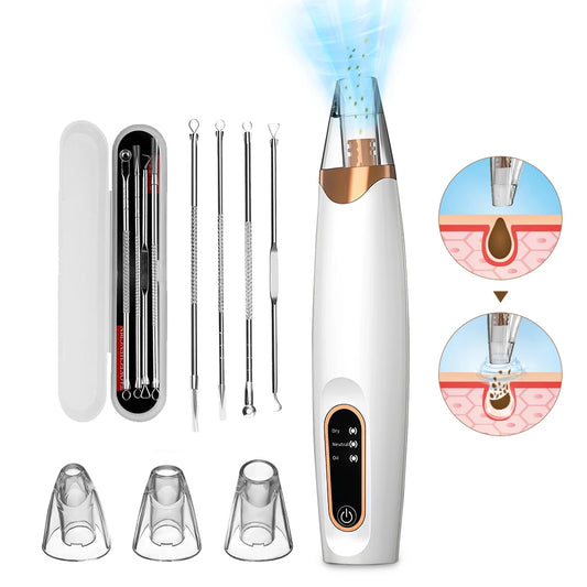 Aspirateur à Points Noirs Électrique – Nettoyage des Pores, 3 Niveaux d’Aspiration & Peau Nette